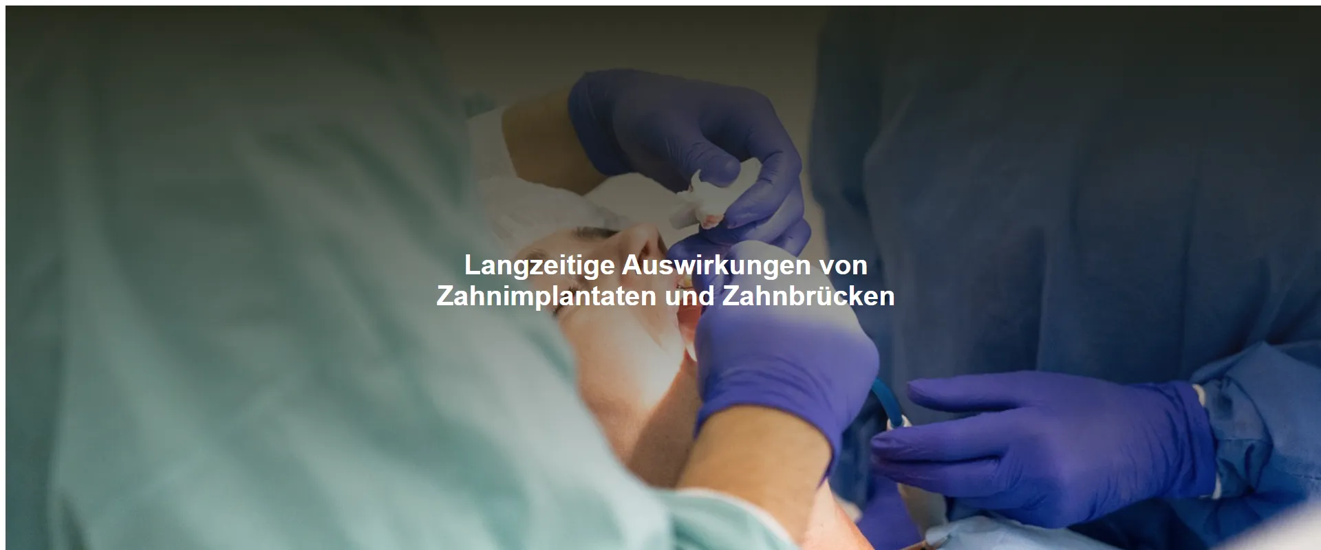 Langzeitige Auswirkungen von Zahnimplantaten und Zahnbrücken